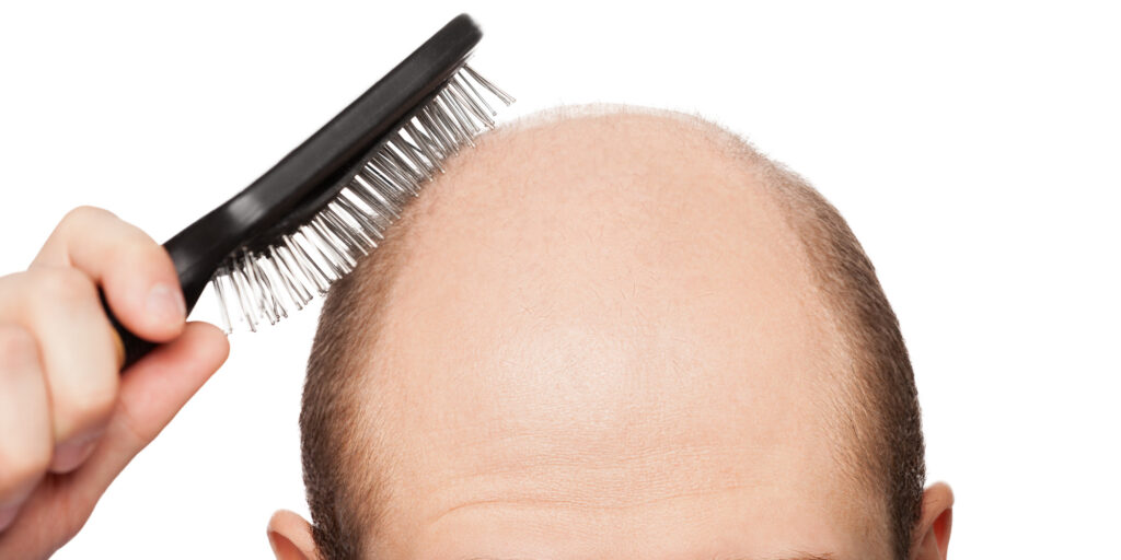 Hair loss